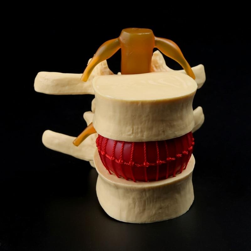 Mega Loja dos Produtos Modelo Anatômico - Vértebra